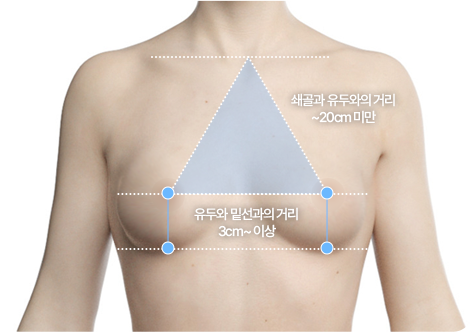 정상 가슴 위치 기준 설명 이미지