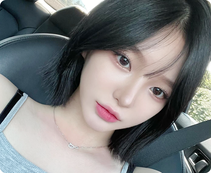 광대축소술 수술 대상 얼굴형
