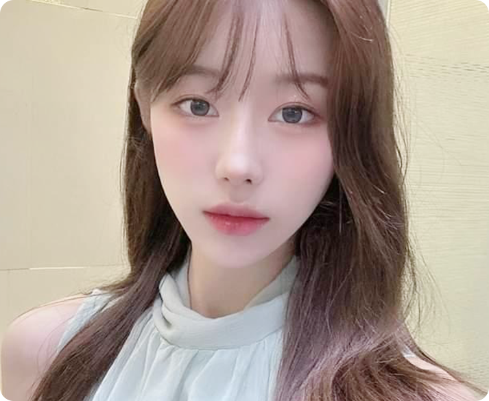 퀵광대축소 수술 대상 얼굴형 예시