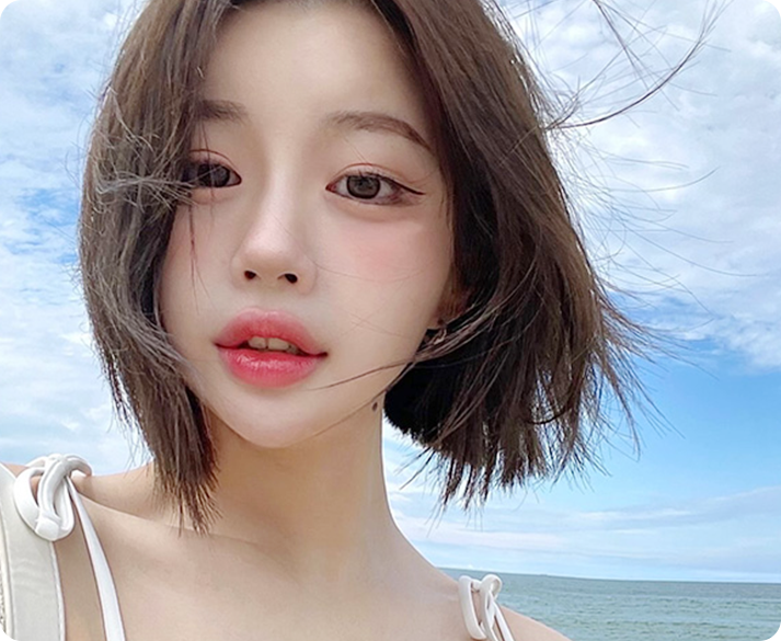 앞광대 교정술 전후 얼굴라인 개선