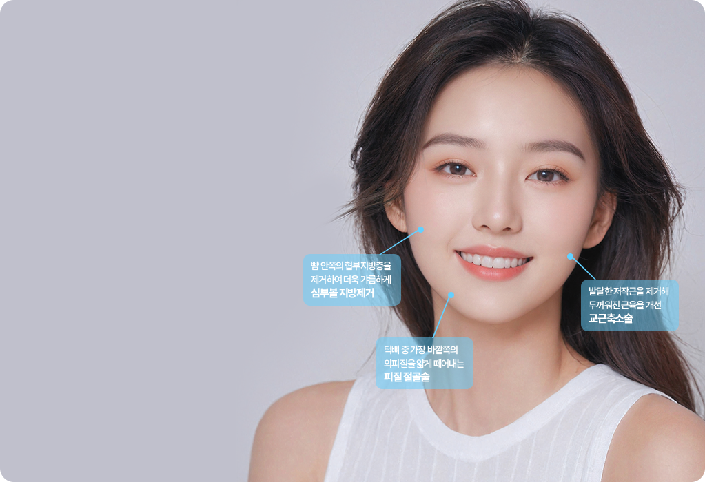 사각턱수술 턱라인 절골 방식