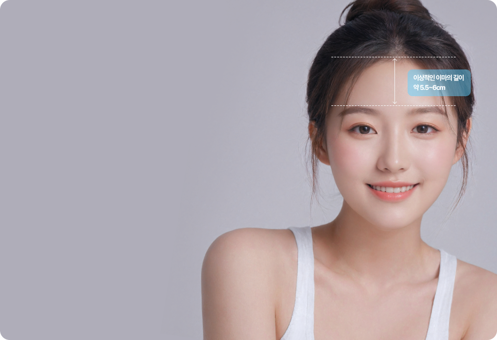 이마축소 수술 디자인 설명 이미지