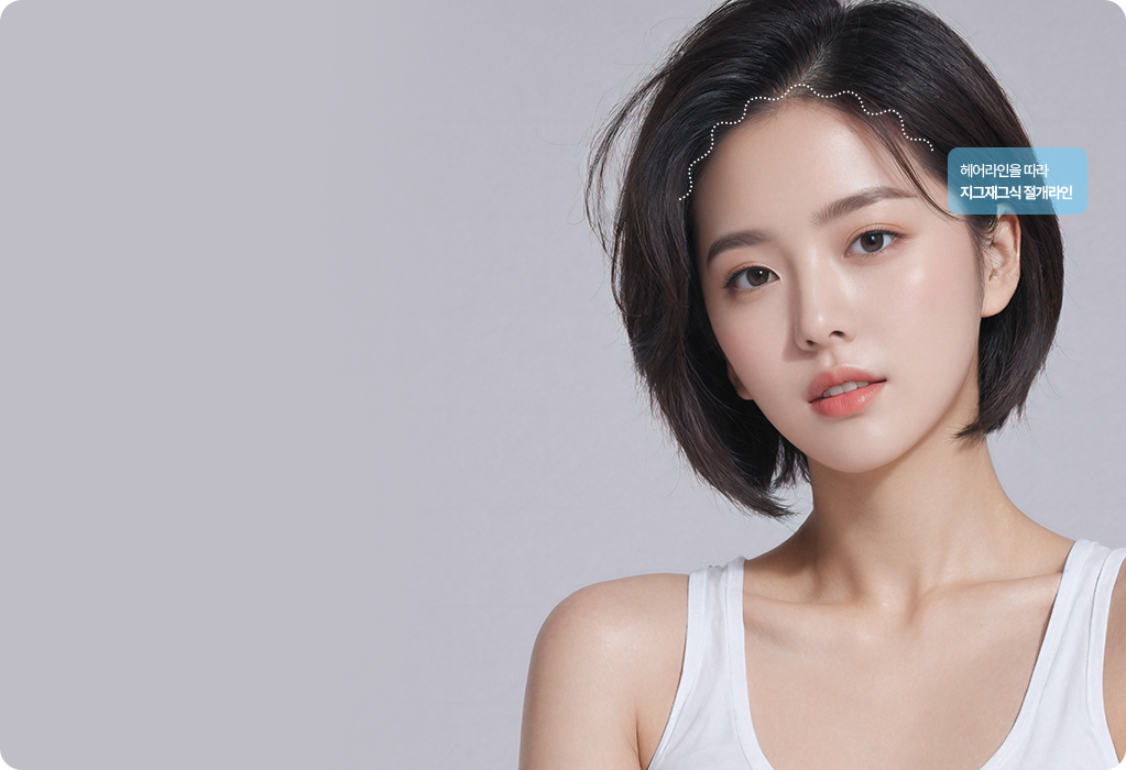 이마축소 절개선 디자인