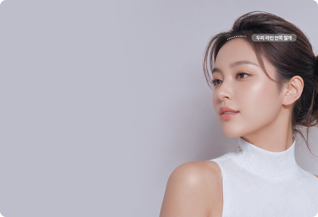 이마보형물 두피절개 흉터 최소화 수술 방식