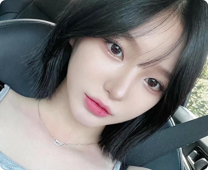 부산 서면 콧볼성형 콧볼축소 수술 대상