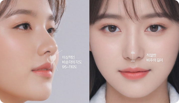 부산 서면 코끝성형 비순각 디자인 설명