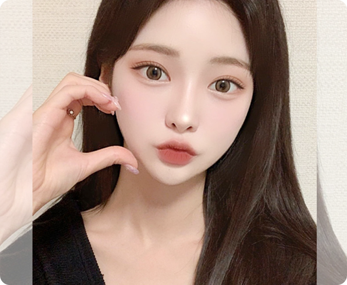 부산눈썹거상 수술 대상 개선 사례