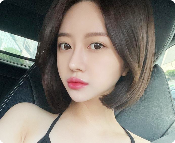 부산 서면 이중턱 근육묶기 활경근 교정 리프팅 수술 대표 이미지