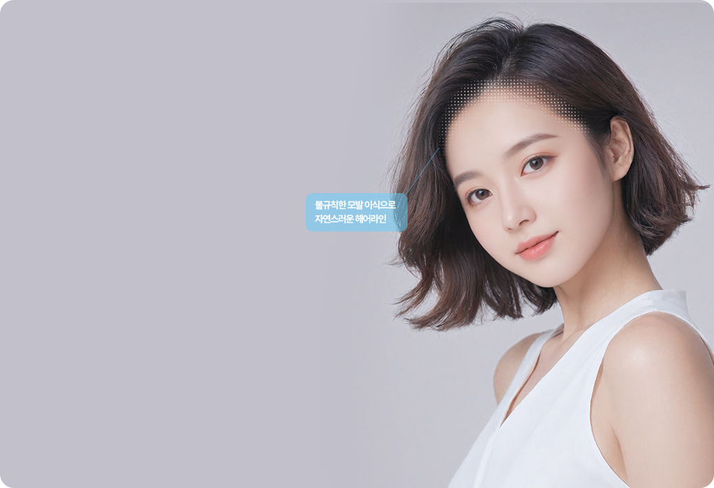 부산 서면 헤어라인 모발이식 자연스러운 라인 디자인