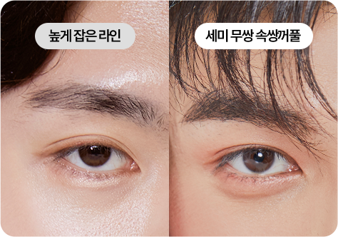 남자 눈매교정 라인 높이 조절 설명 이미지