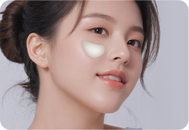앞광대 보형물 삽입술