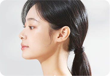 이마보형물 맞춤 제작 과정