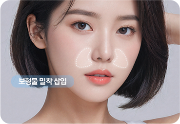 귀족보형물 밀착 삽입