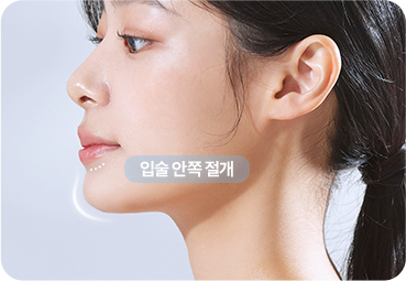 입안 절개 무턱 보형물 삽입