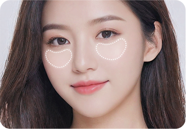 앞광대 맞춤 보형물 제작