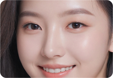 부산 서면 코성형 수술 후 맞춤 콧대 라인 완성