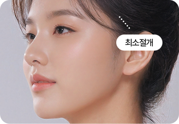 부산 미니리프팅 최소절개 과정