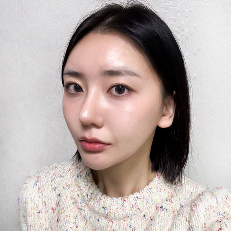 윤곽 1년 후