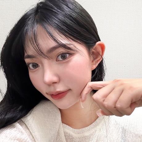 코성형 3개월!