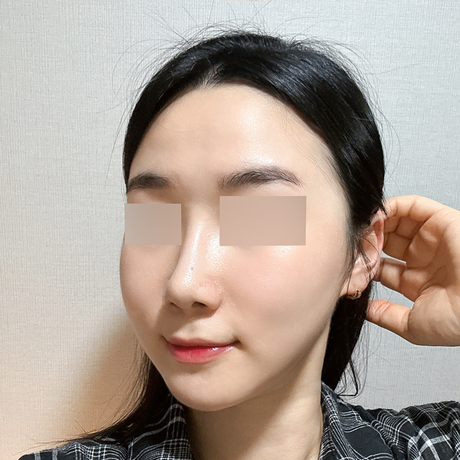 안면윤곽하고 사진 찍을 맛 납니다